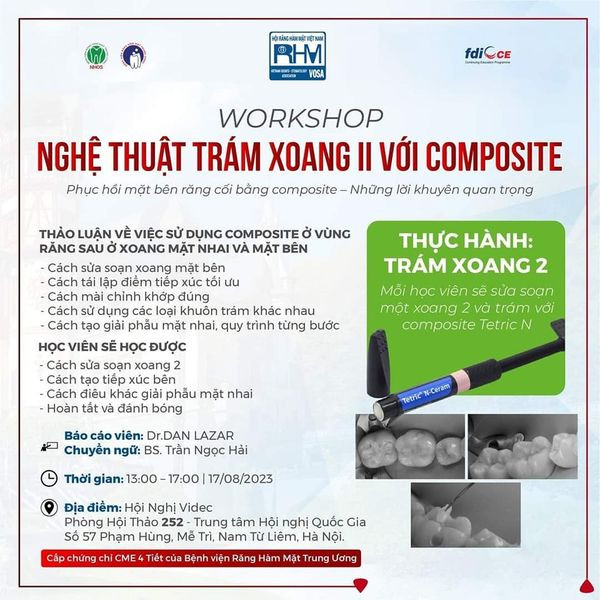 (VIDEC 2023) WORKSHOP: NGHỆ THUẬT TRÁM XOANG II VỚI COMPOSITE Phục hồi mặt bên răng cối bằng composite – Những lời khuyên quan trọng